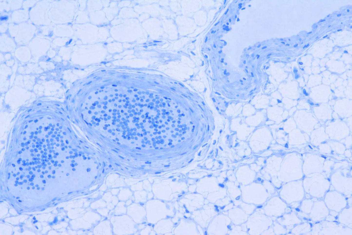 TRANSIL Equilibrium Shift Assay