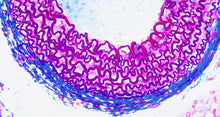 Load image into Gallery viewer, Artery illustration
