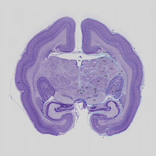 TRANSIL Brain Absorption Kit