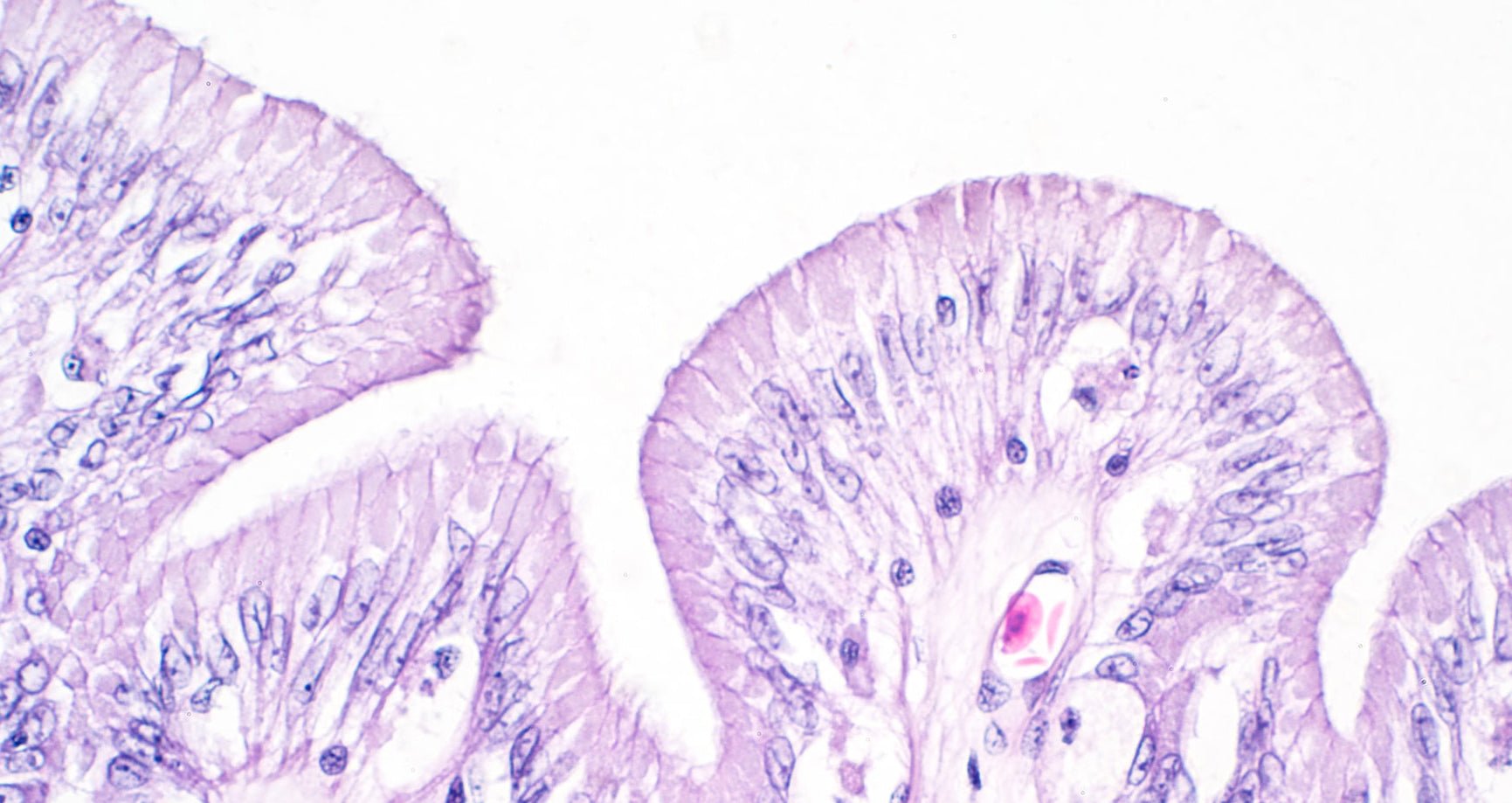 Large intestine tissue under microscope
