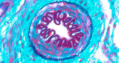 Elastic lamina illustration